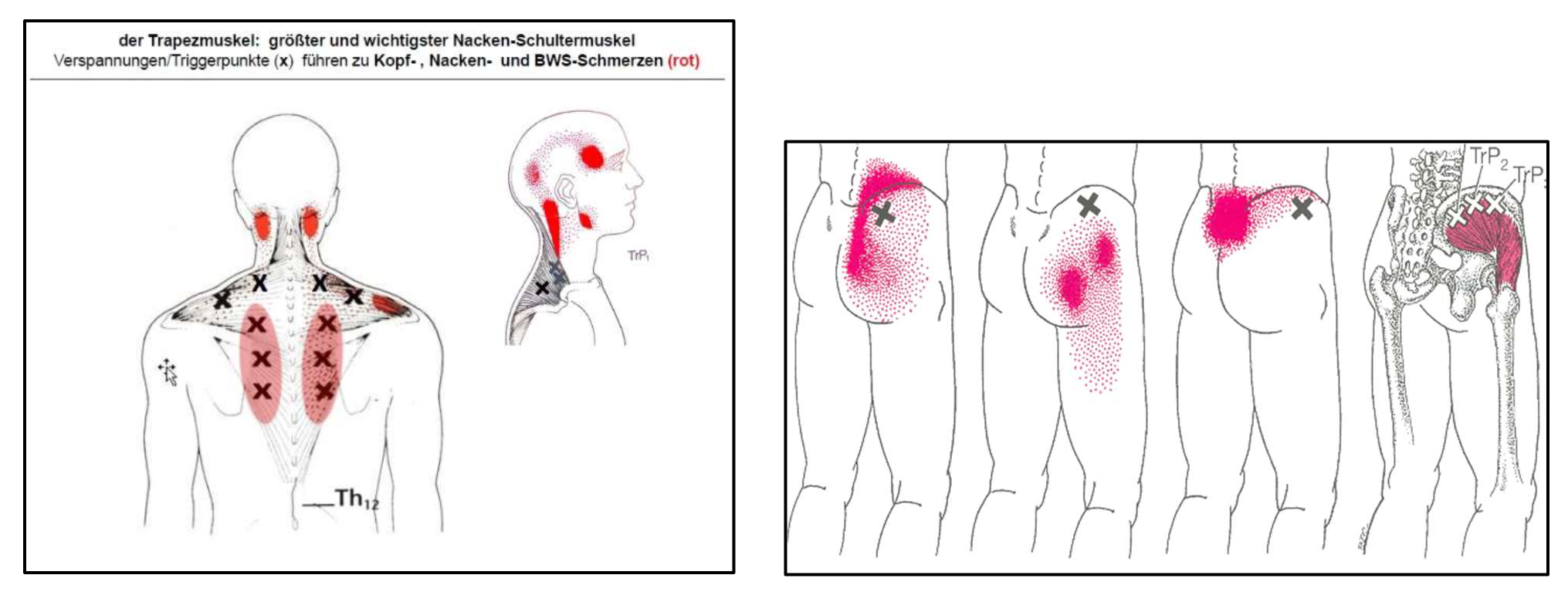 Neuraltherapie 